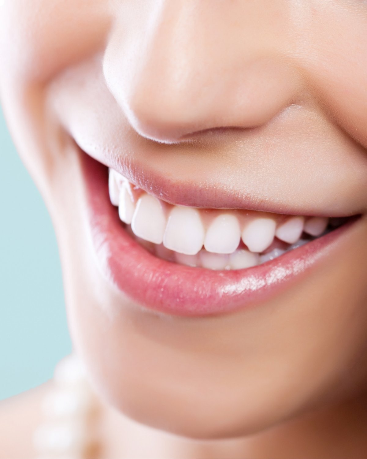 Sorriso com facetas de porcelana, de aparência natural